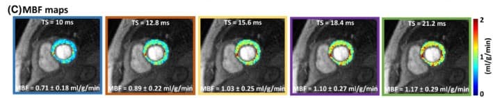Quantitative cardiac perfusion MRI blood-flow maps relevant to stress perfusion CMR