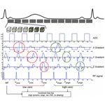 Dual-venc flow MRI image relevant to 5D flow MRI methods