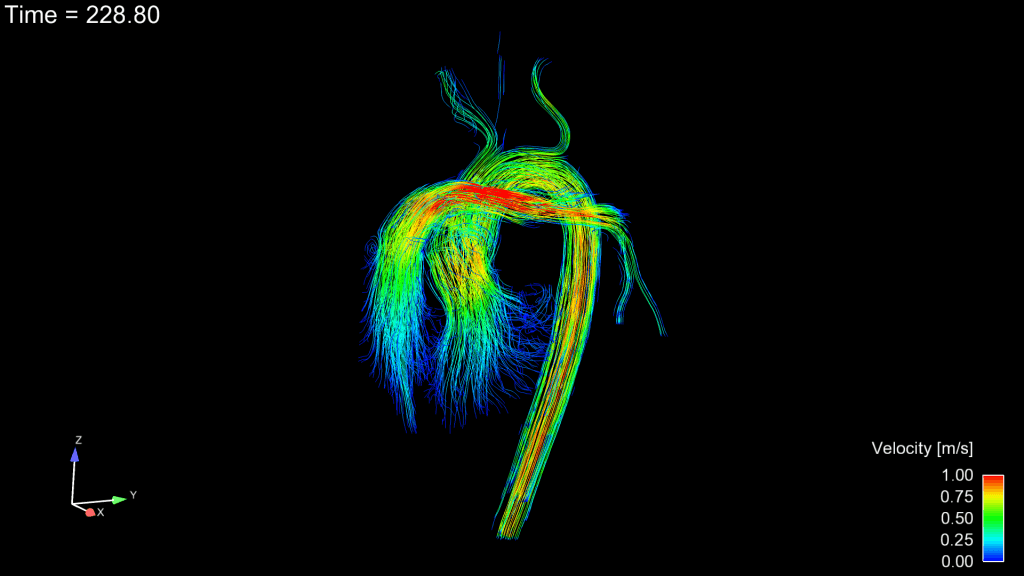Congenital streamlines image.